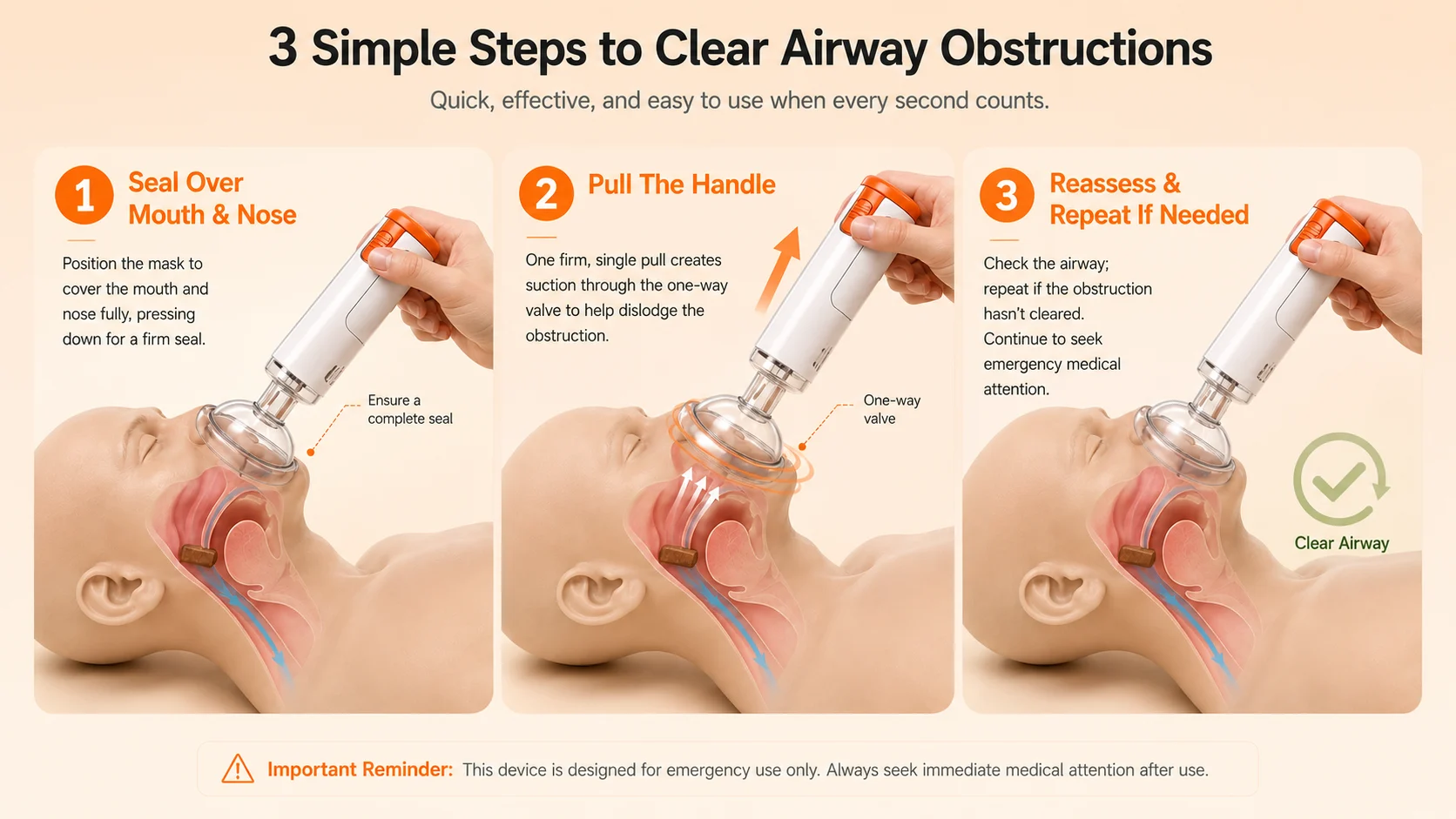 Anti-Choking Rescue Device — 3 Simple Steps